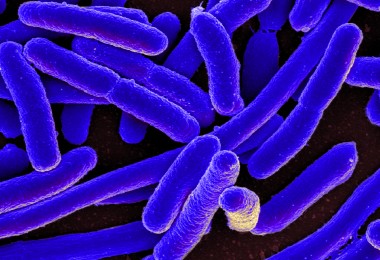 Poza a bacteriei Escherichia Coli